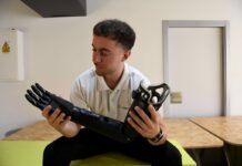 Tecnología murciana para fomentar la accesibilidad: Limbium desarrolla las primeras prótesis de brazo deportivas de Europa